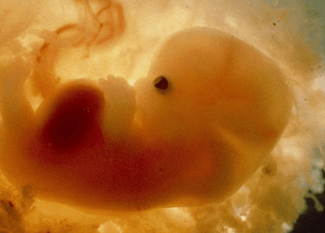 女子怀孕30周产检无胎心, 剖腹取出孩子后, 医生落泪: 曾经挣扎过