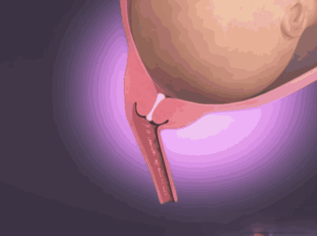 破水,宫缩,开宫口……3d高清图让你更明白生孩子的全过程!