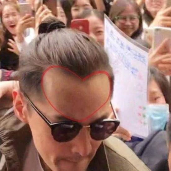 发际线逆天的明星:胡歌暴露"美人尖",杨幂唐嫣发际线太靠后
