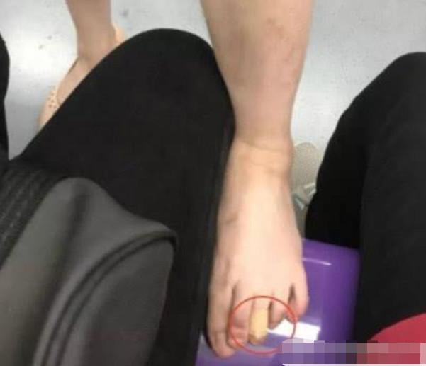 女子地铁没座位,脱鞋光脚踩别人屁股旁边,女子:我脚上有创口贴