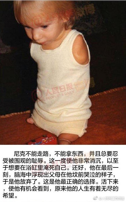 半身奇迹尼克胡哲将来南昌开讲传奇人生