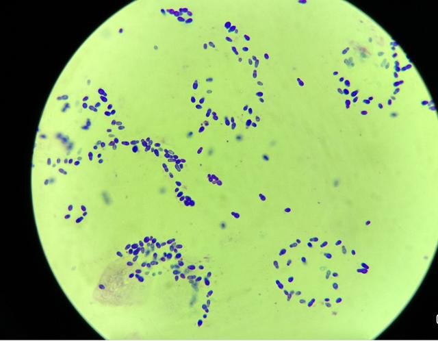 宠物耳朵里的分泌物在显微镜下别有一番洞天