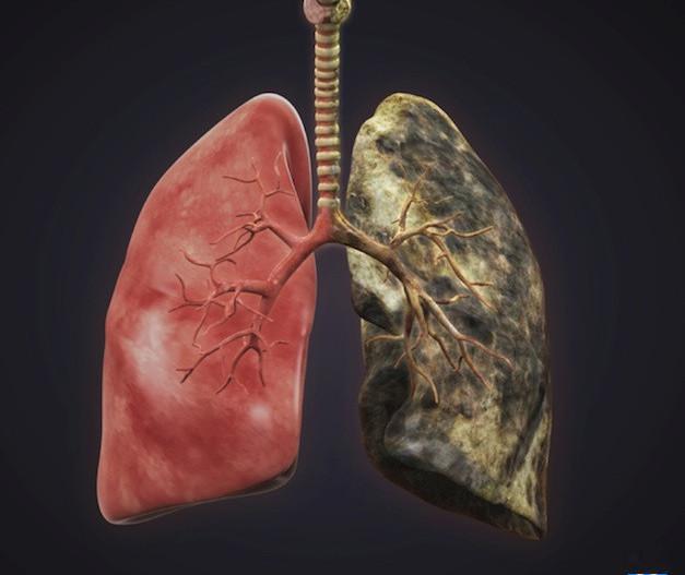 戒烟一年的肺图片图片