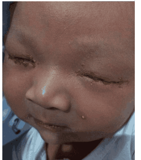 新生儿宝宝迟迟不睁眼, 婆婆强行掰开用嘴舔, 检查后医生怒斥无知