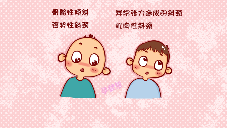 别傻了,这是一种病|斜颈|宝宝|可爱_新浪新闻