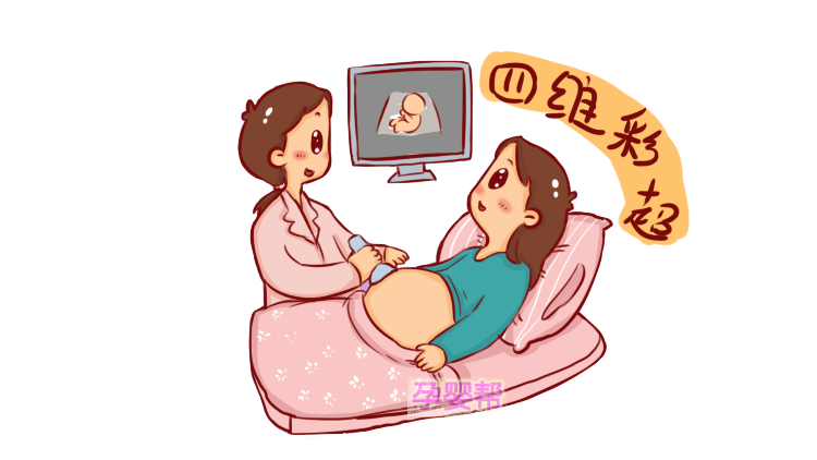 什么是四维彩超?