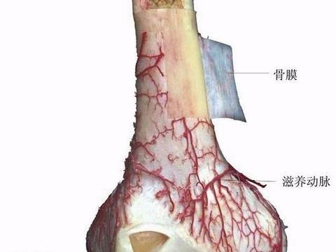 冒烟型骨髓瘤图片