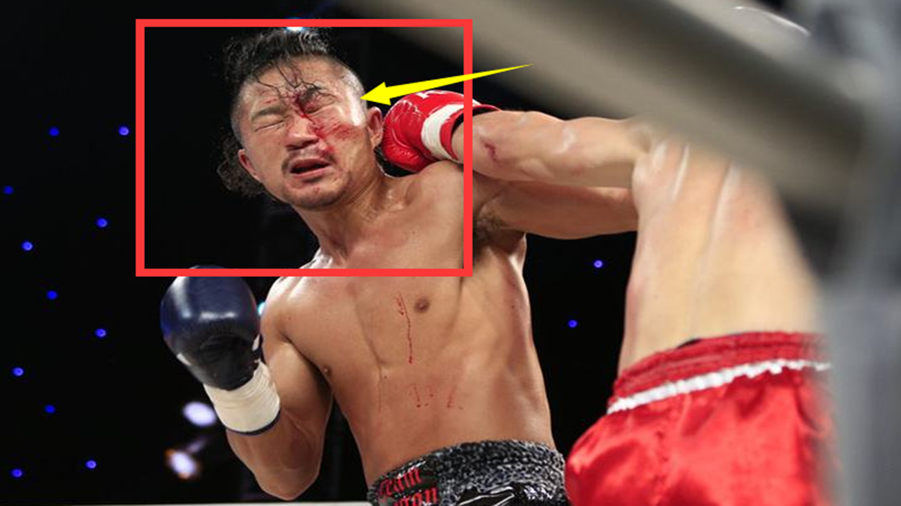 日本拳王被中国新人王残暴暴打到满头流血 接下来日本教练看怕了 日本拳王被中国新人王残暴暴打到满头流血 接下来日本教练看怕了