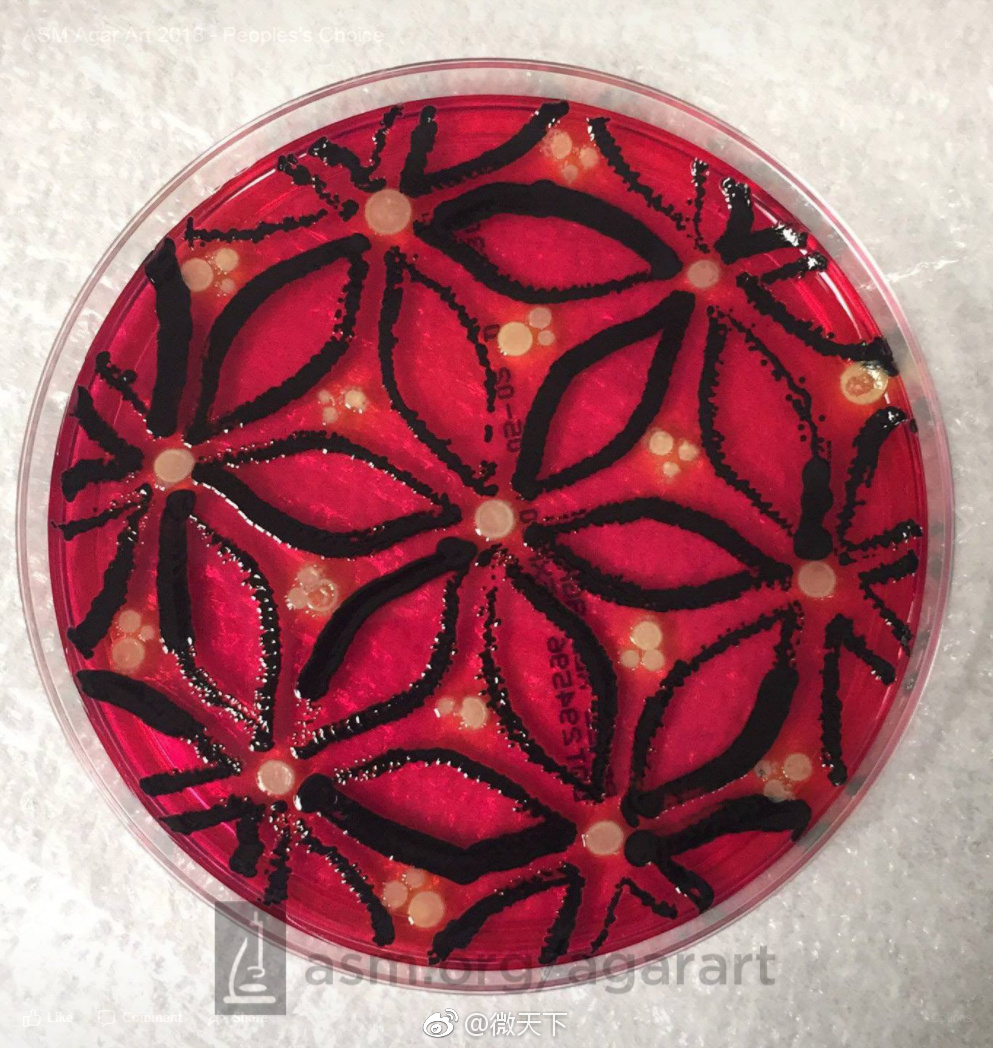 你在纸上画画还不行人家已经拿培养基画画了