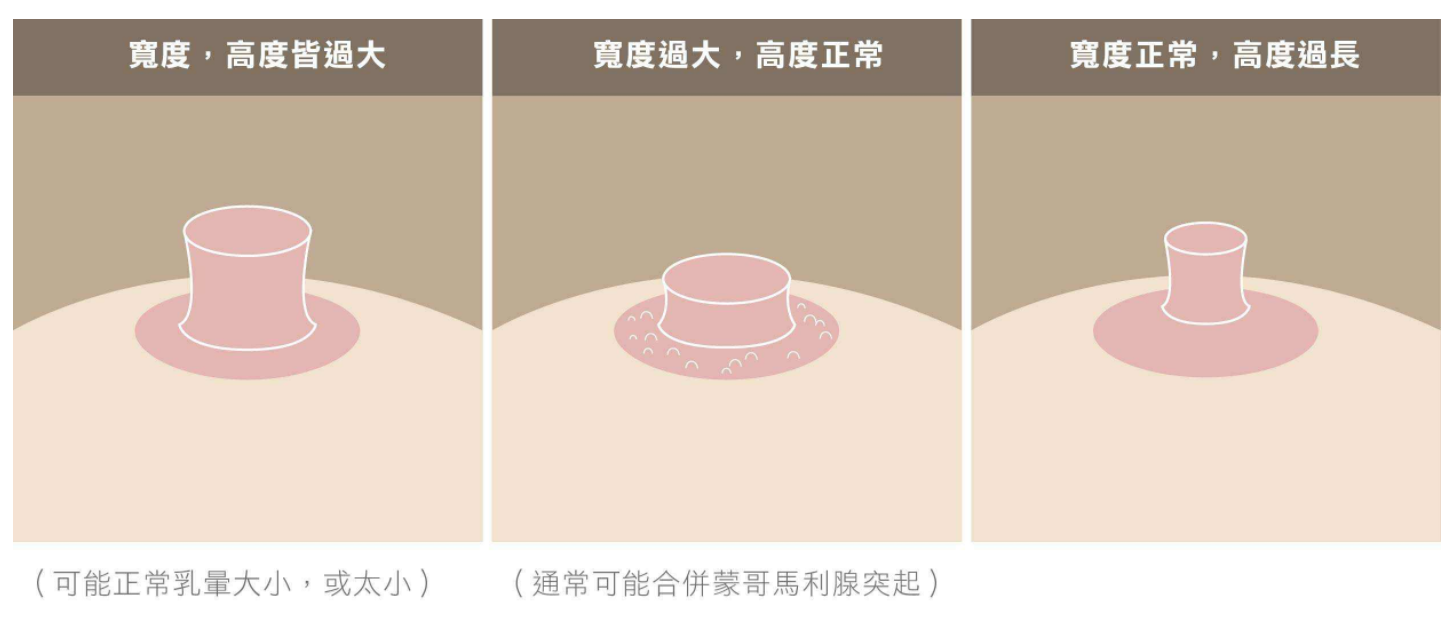 ②乳头较长的讀况假期过后的你是什么状态?