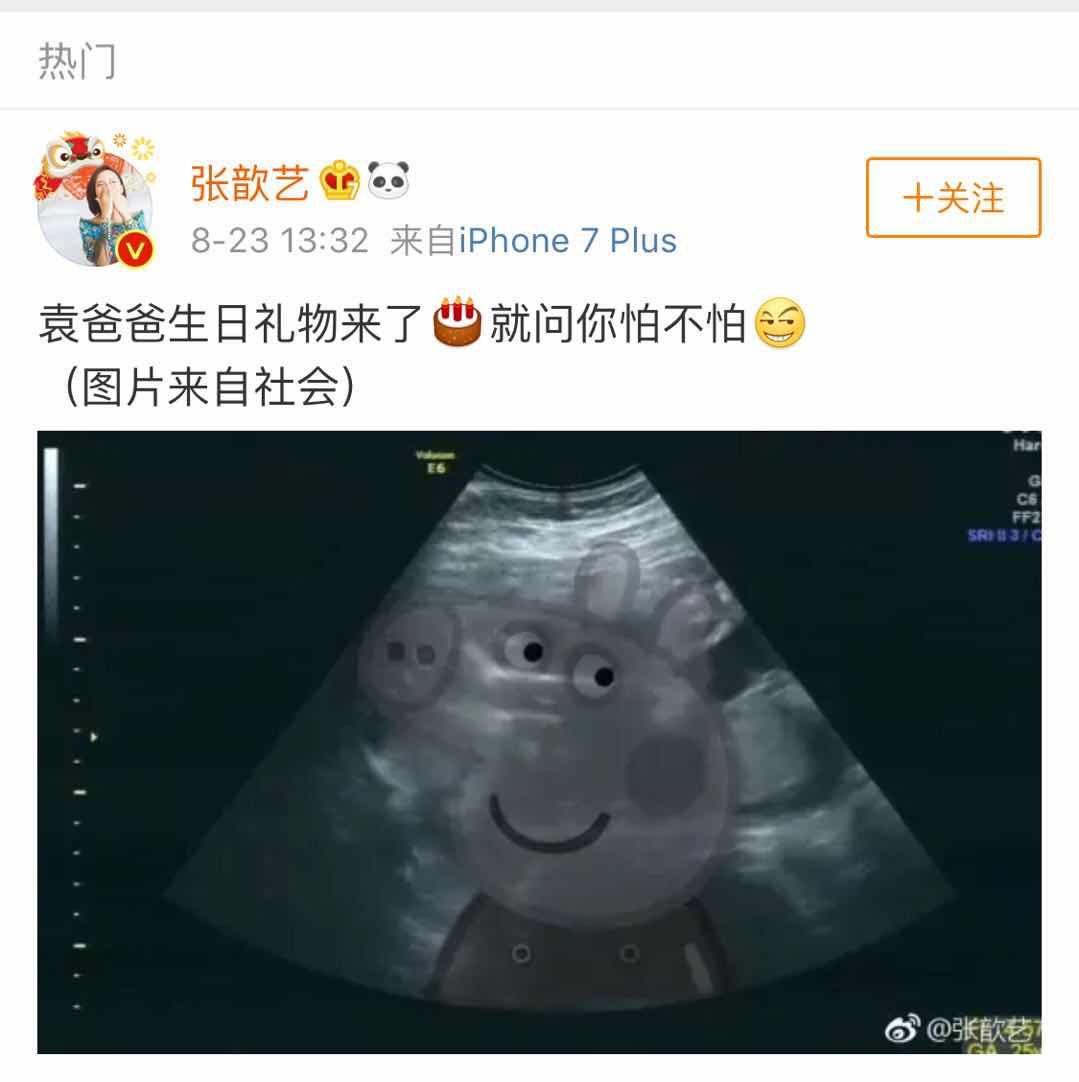张歆艺怀孕:经历群嘲,掉粉,如今他们终于迎来最好的时光