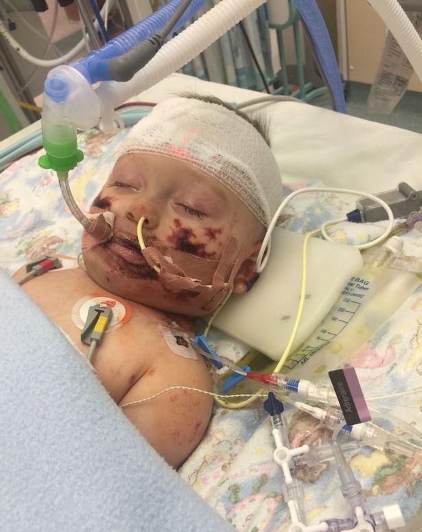 不到一岁的宝宝因病截取四肢,手术后的这表情更让人看的心痛