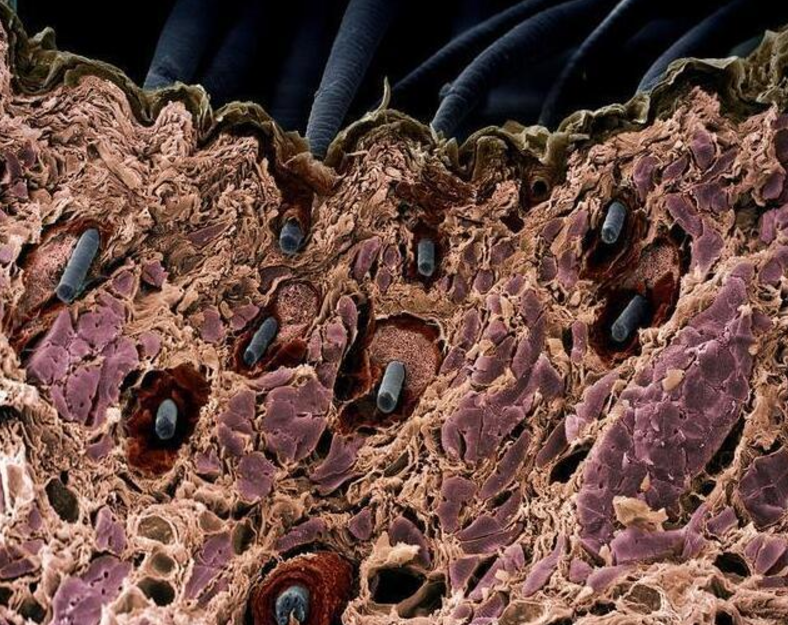螨虫虎视眈眈一旦头上出现5种情况不要犹豫除螨势在必行