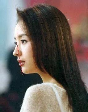 多年经验总结,凸嘴、下巴后缩解决方法一网打