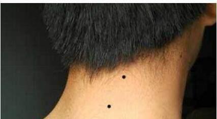 男生这4个"地方"长痣,天生富贵命,特别第1个,大富大贵!