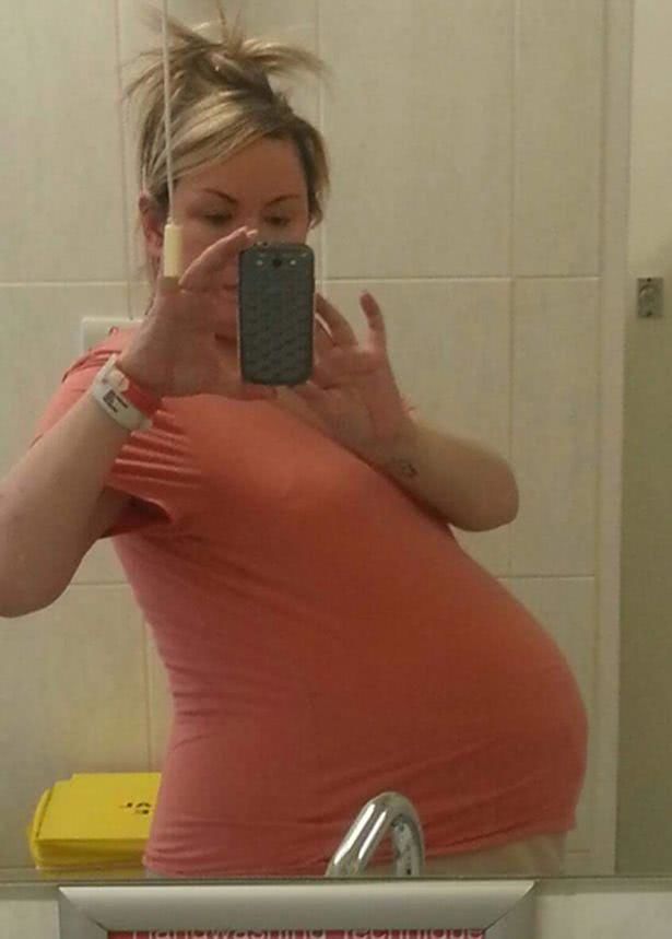 女子四次流产后怀上四胞胎,医生建议她放弃两个以保全另外两个