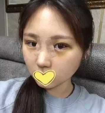 她,竟然是84年单亲妈妈|单亲妈妈|双眼皮|鼻子_新浪新闻