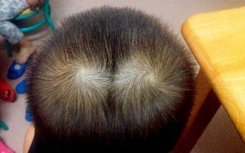 为什么每个人头上都有“旋”？孩子发旋是怎么回事？新妈妈来看看|头发|毛囊|顺时针|胚胎|顺逆_新浪新闻