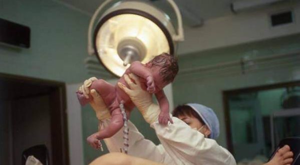 孕妇剖腹产生下二胎,医生打开肚子瞬间,吓得脸色发白