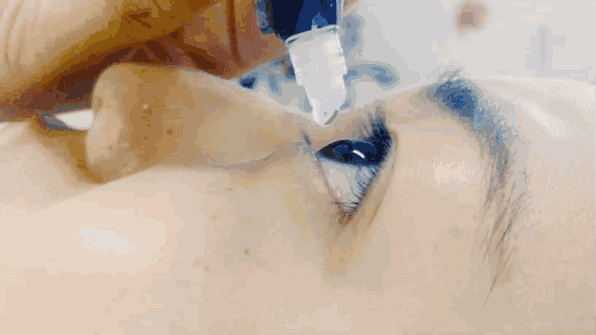 试了几种姿势我们发现,滴眼药水不伤眼