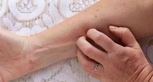 芋头|佳品|黏液_新浪网