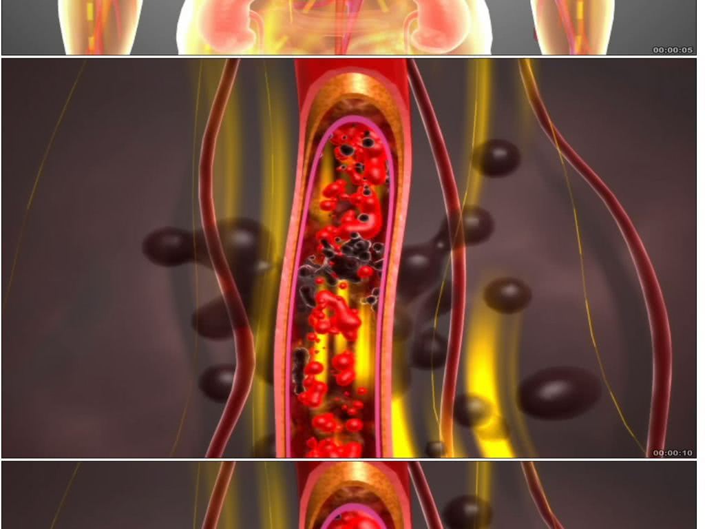 人到40岁无论男女,这些食物要多吃,扫除血管垃圾,不怕血管堵