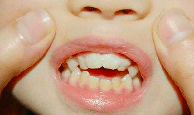 哺乳期宝宝吃奶时姿势很重要, 不信看看周冬雨嘴巴上的小秘密