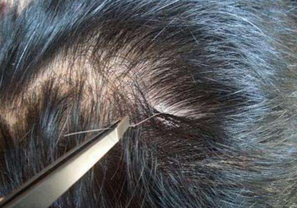 白发的天然救星来了,坚持每天饭后喝点它,据说比染发还管用