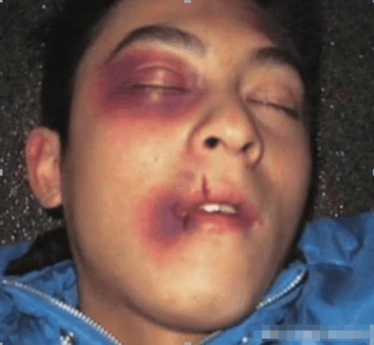 可能是陈冠希最失败的一次了,毕竟是一个打两个根本打不过,只能挨打了