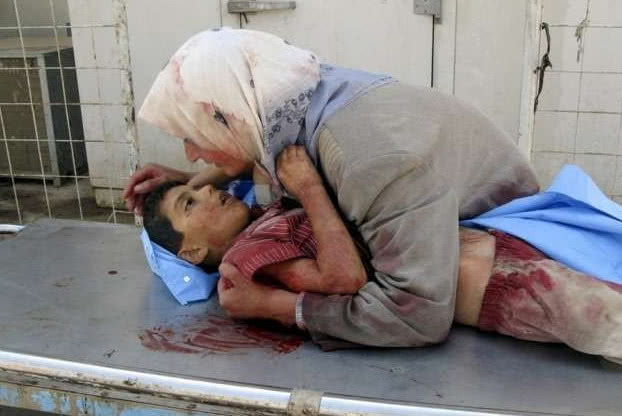 伊拉克战争中最无辜的就是这些孩子悲惨现状看一张哭一张