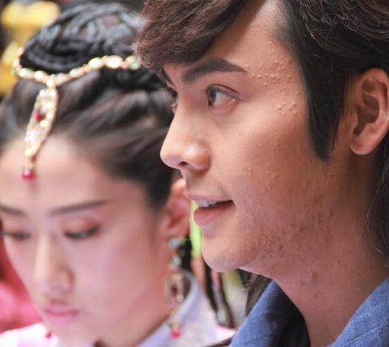 男星素颜照,王俊凯满脸痘,蔡徐坤双眼无神,易烊