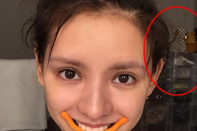 张予曦晒素颜照,眼尖的网友却发现了猫腻,究竟是什么呢?