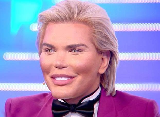 巴西34岁男子为变芭比娃娃花300多万整容60余次成这样