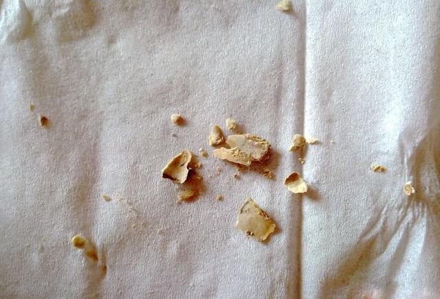 在口腔内不同的部位,形成的量也有所不同,在唾液腺导管口相对处的牙面