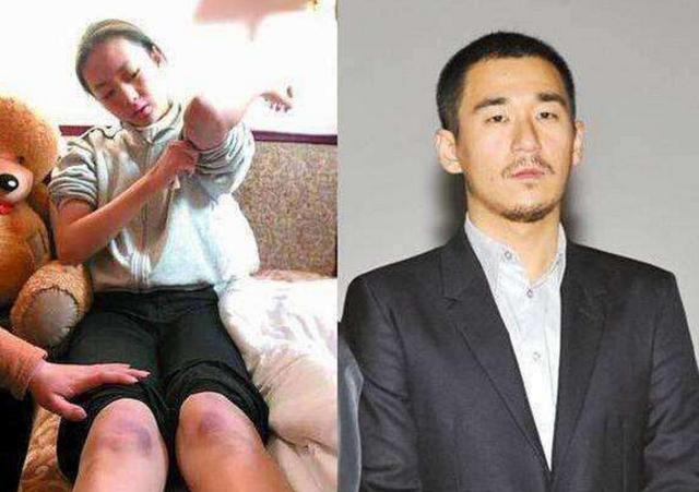 张默暴打女友童谣为哪般?真相被揭露!网友:贵圈太乱!