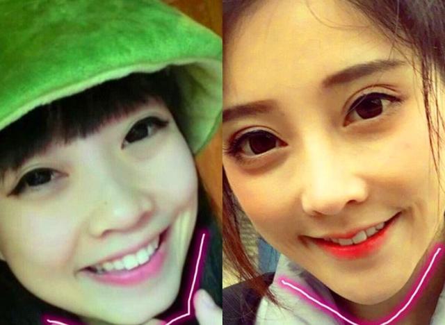 冯提莫旧照曝光!网友吐槽,这不是判若两人,这是触目惊心!