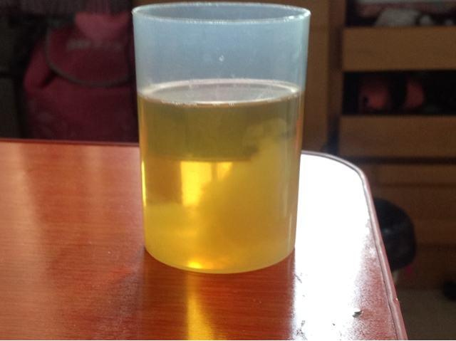 尿液|孕妇|人中白_新浪新闻