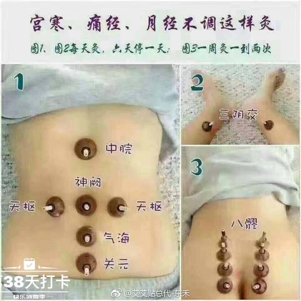 女性朋友们,你们真的懂艾灸吗?