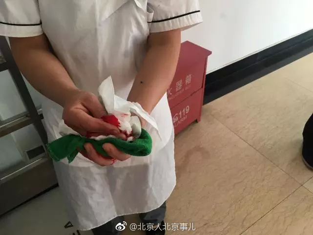 北京一厨师手被卷入压面机!6月12日8点13分_新浪看点