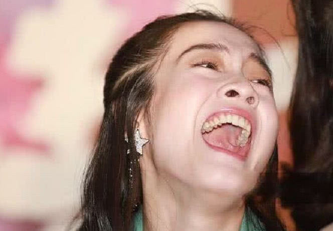 女星大笑李小璐脸变形唐嫣毁容最后一位惨不忍睹