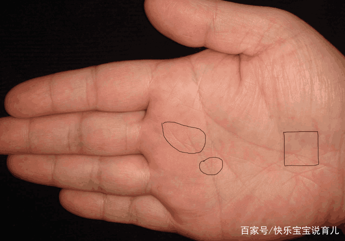 性别|掌纹|胎儿性别_新浪新闻