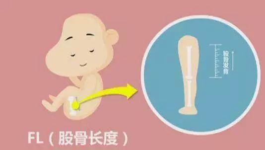 第二个胎儿的头围双顶径实际上就是胎儿两个顶骨之间的距离,我们可以