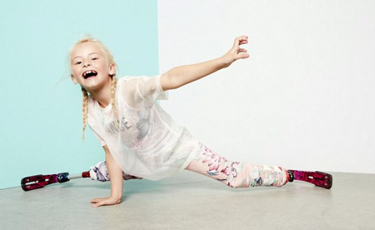 双腿截肢的7岁英国小姑娘装上义肢t台走秀,气场不输名模!