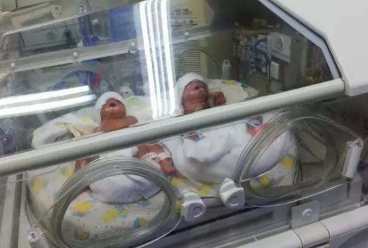 妈妈生下双胞胎,弟弟不幸夭折