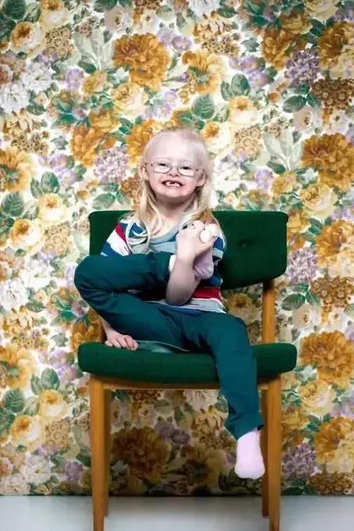 双眼的距离比较远,眼睛向上斜,鼻梁骨平坦,嘴,牙齿和耳朵细小……唐氏