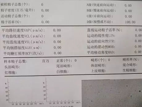 腮腺炎|流行性|睾丸炎_新浪新闻