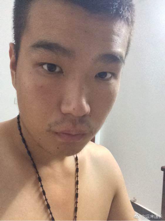 婚后家暴可能性非常大的一款面相额头凹陷明显学业事业运势差