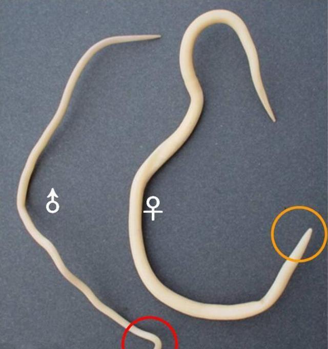 孩子这几个症状就是肚子长了蛔虫
