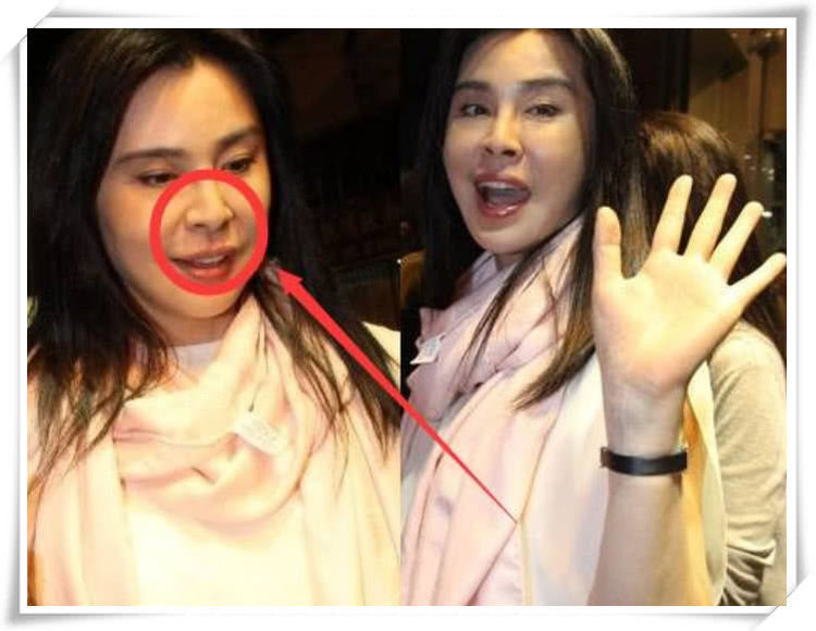 整容失败的女星太惨,除了张檬之外,一直被称为"女神"的她也假