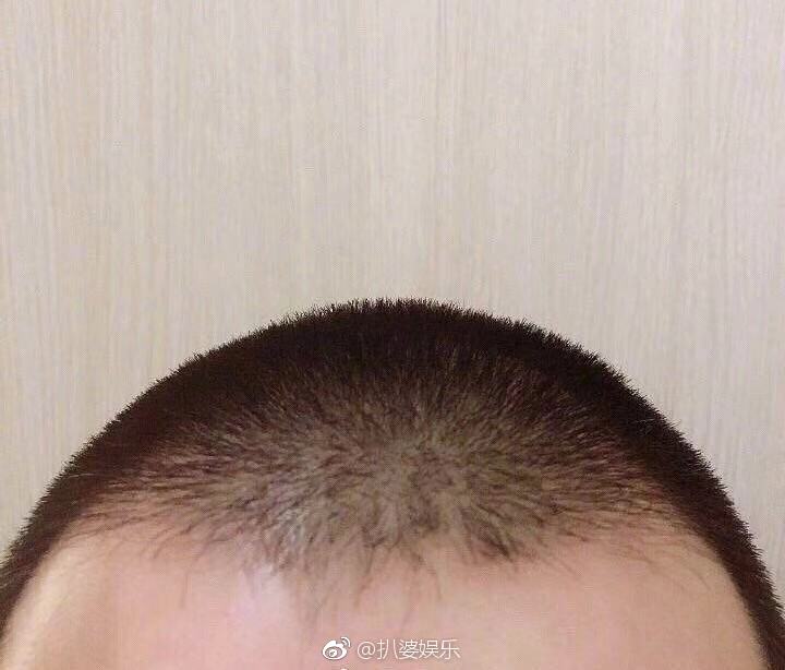 悲伤到呕吐,小猪你忘记了大明湖畔的朱碧石了吗?